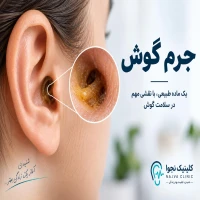 جرم گوش